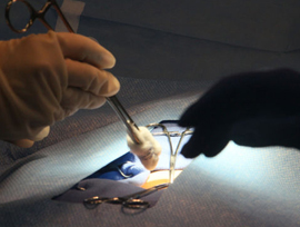 surgery